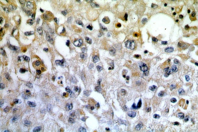 PLK4 Antibody in Immunohistochemistry (Paraffin) (IHC (P))