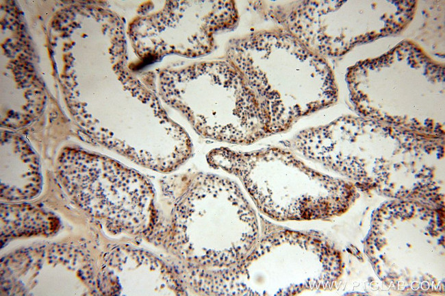 PLK4 Antibody in Immunohistochemistry (Paraffin) (IHC (P))