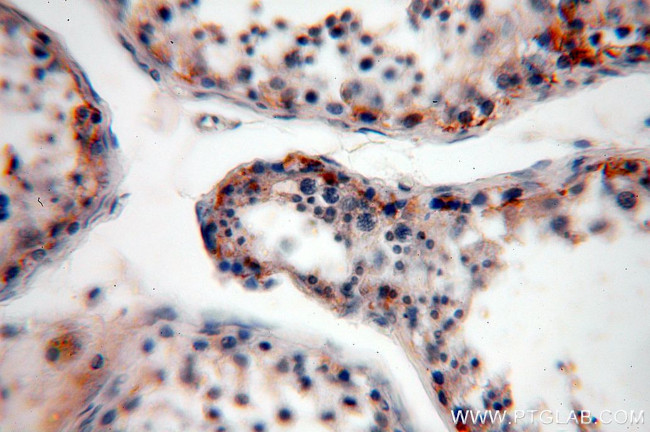 PLK4 Antibody in Immunohistochemistry (Paraffin) (IHC (P))