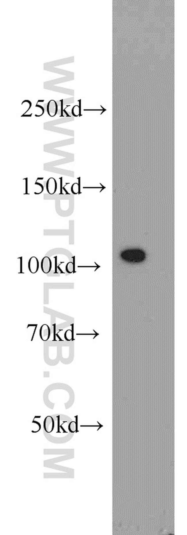 PLK4 Antibody in Western Blot (WB)