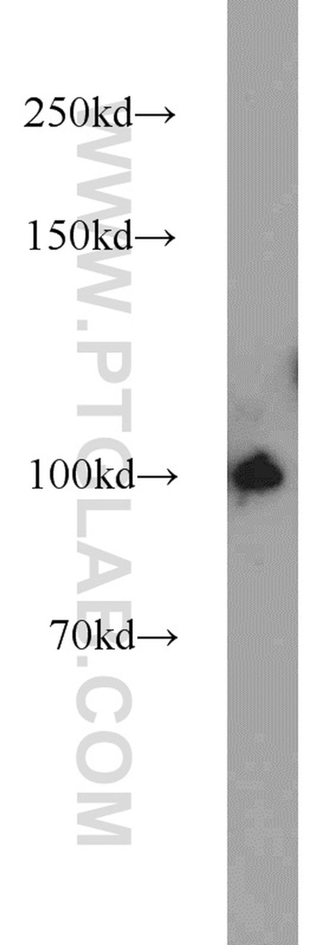 PLK4 Antibody in Western Blot (WB)