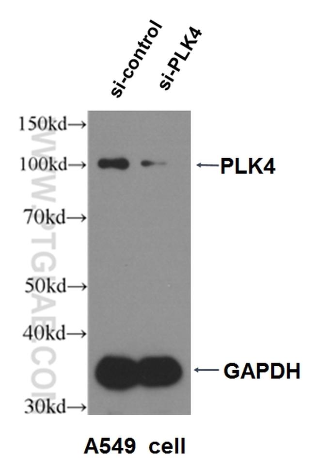 PLK4 Antibody in Western Blot (WB)