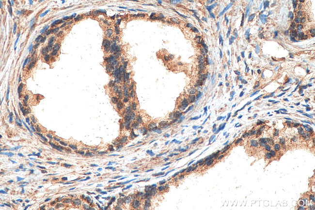 ILK Antibody in Immunohistochemistry (Paraffin) (IHC (P))