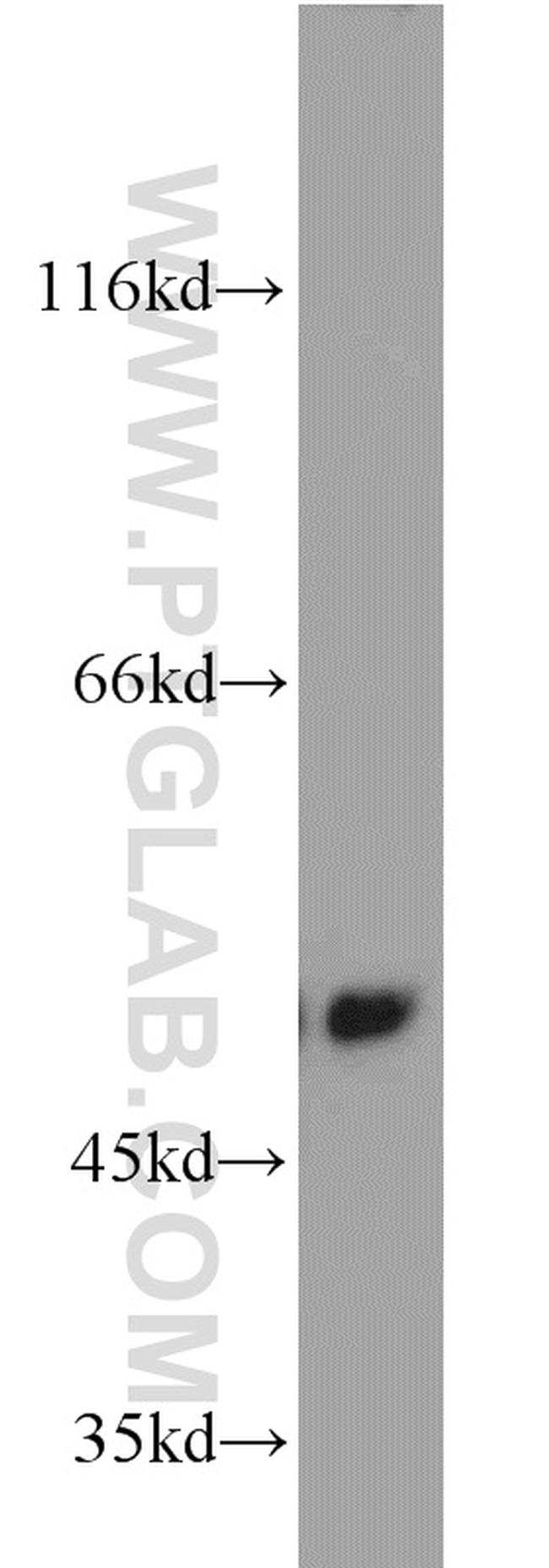 ILK Antibody in Western Blot (WB)