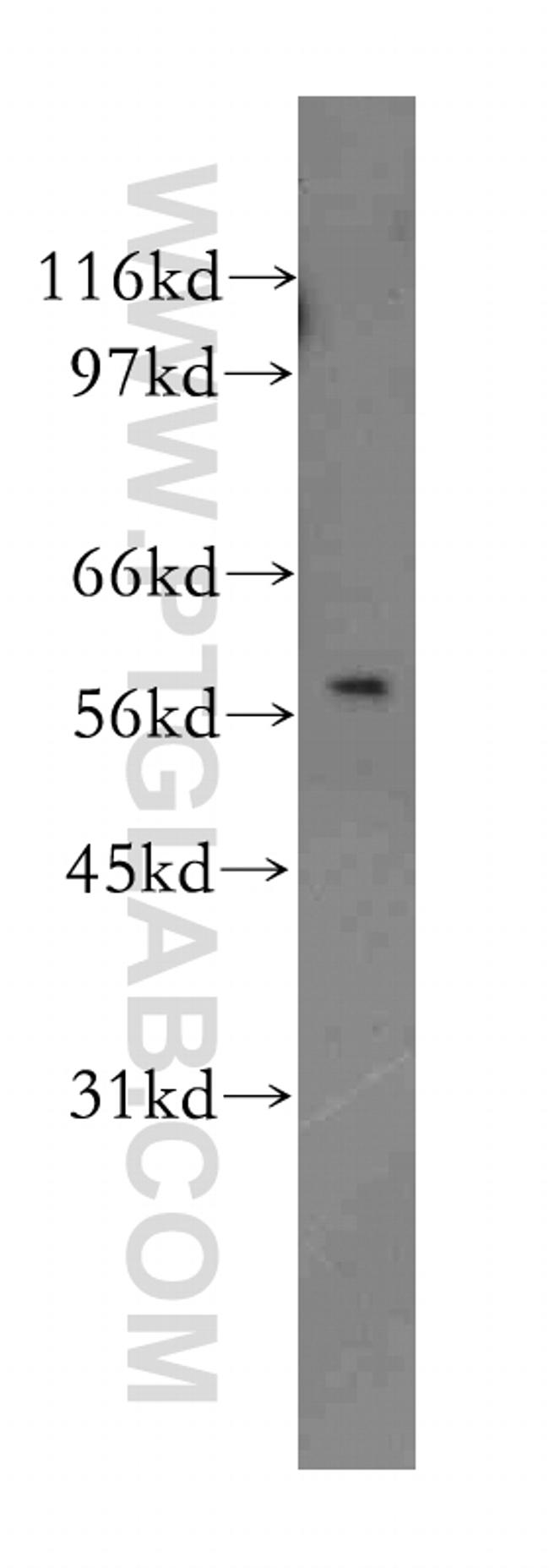 ILK Antibody in Western Blot (WB)