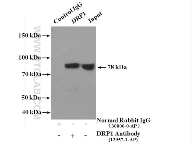 DRP1 (C-terminal) Antibody in Immunoprecipitation (IP)