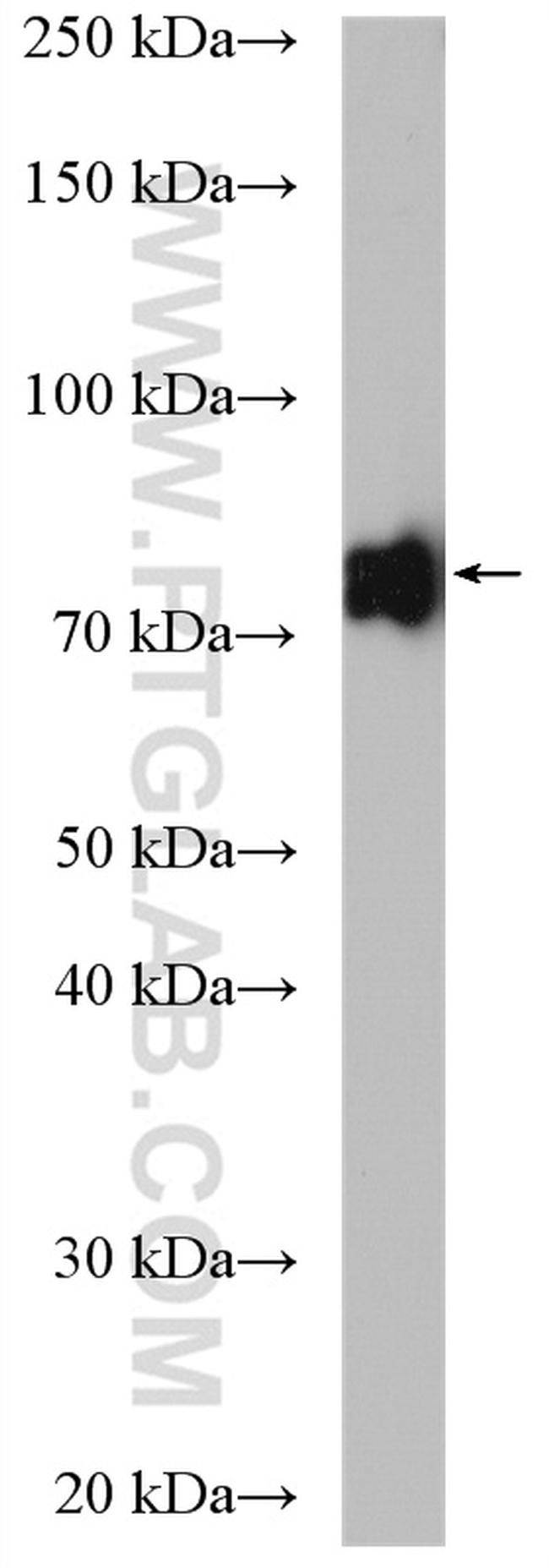 DRP1 (C-terminal) Antibody in Western Blot (WB)