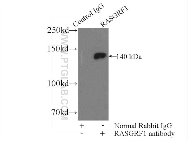 RASGRF1 Antibody in Immunoprecipitation (IP)
