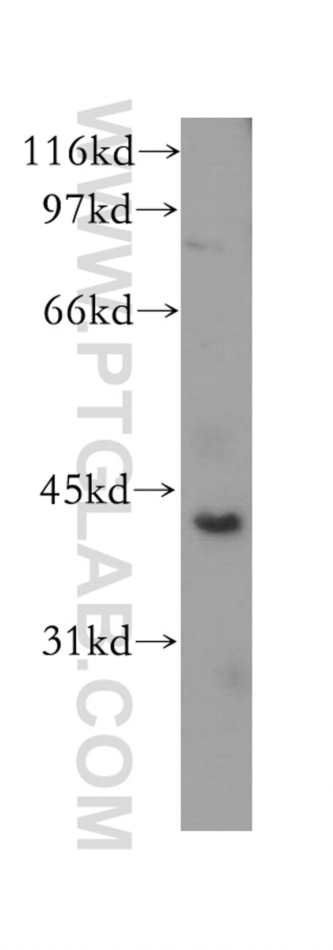 CHAD Antibody in Western Blot (WB)