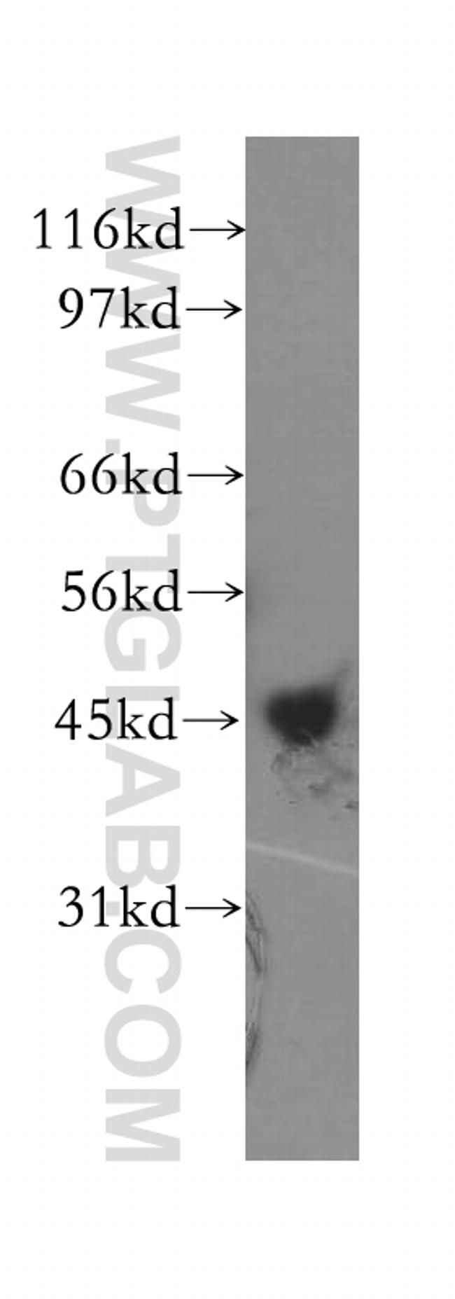 CHAD Antibody in Western Blot (WB)