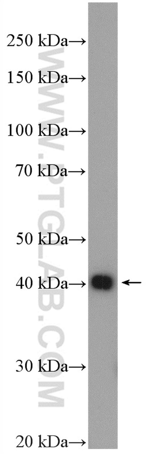 CHAD Antibody in Western Blot (WB)