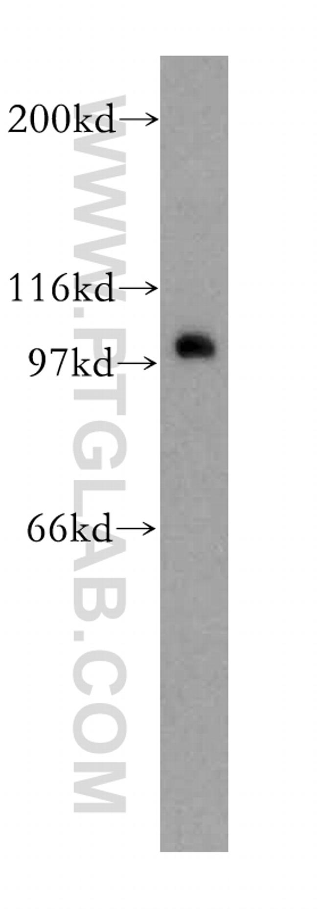 CDC5L Antibody in Western Blot (WB)