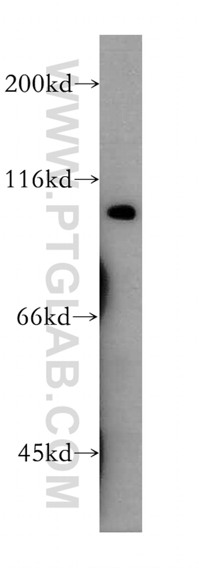 CDC5L Antibody in Western Blot (WB)