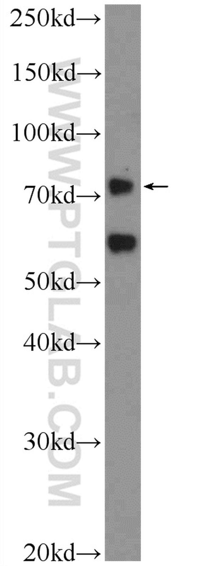 PASD1 Antibody in Western Blot (WB)