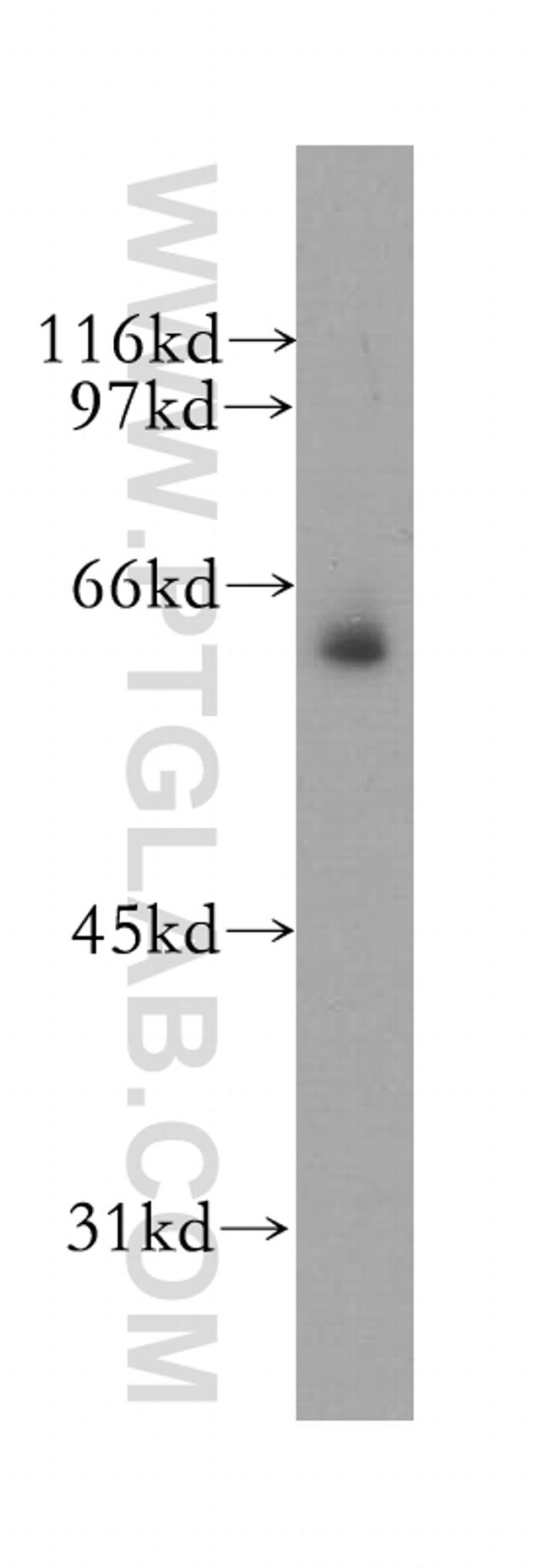 MSL3 Antibody in Western Blot (WB)