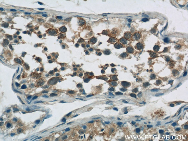 TPTE Antibody in Immunohistochemistry (Paraffin) (IHC (P))