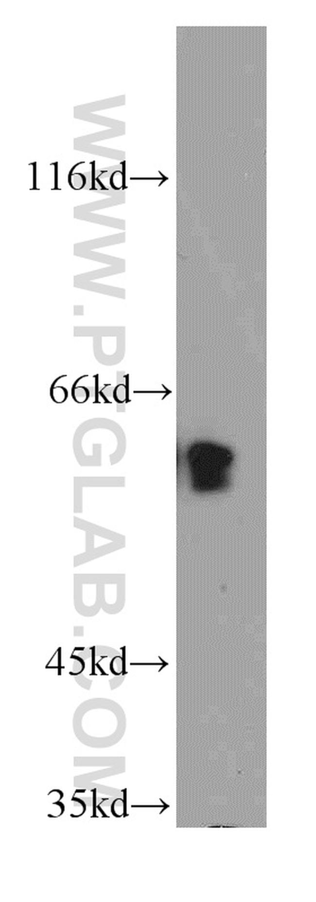 TPTE Antibody in Western Blot (WB)