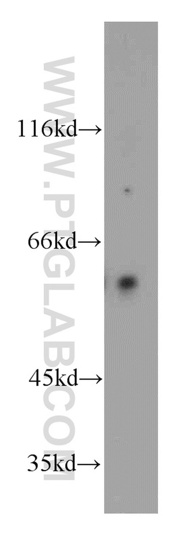 TPTE Antibody in Western Blot (WB)