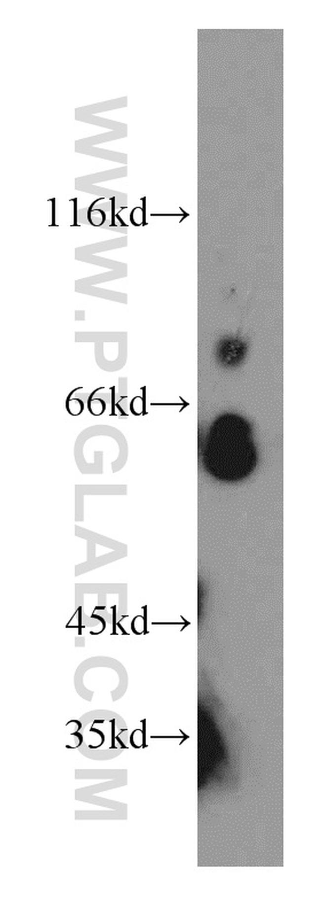 TPTE Antibody in Western Blot (WB)