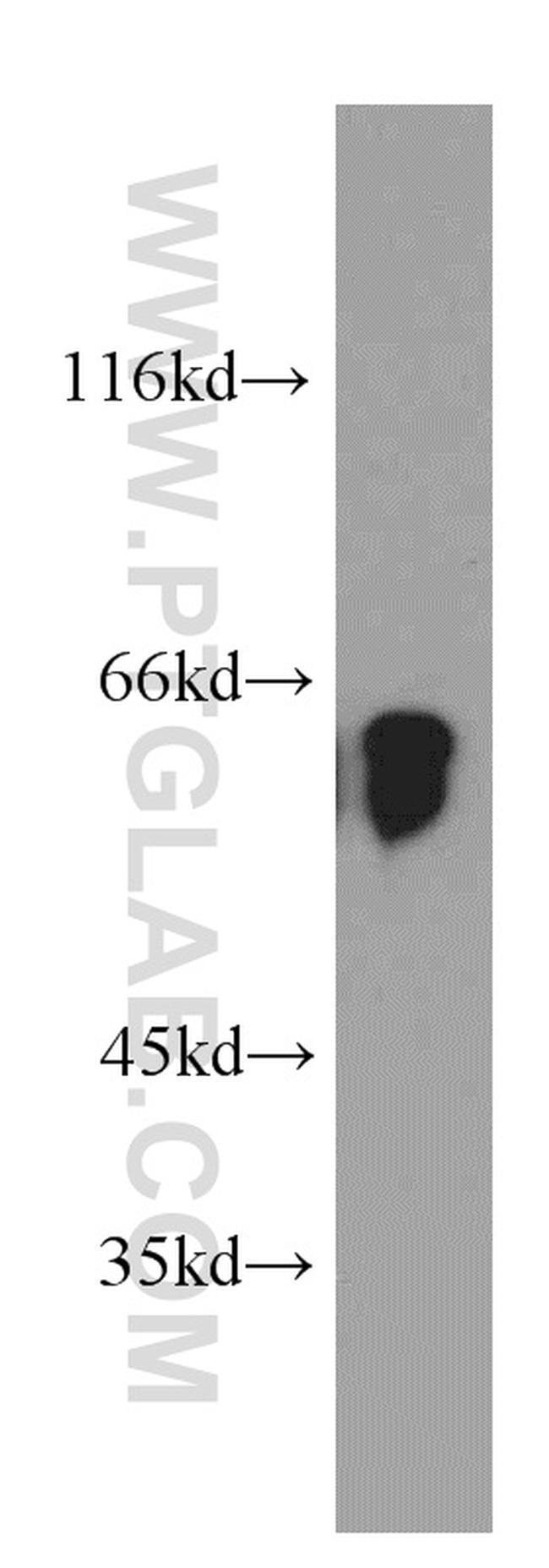 TPTE Antibody in Western Blot (WB)