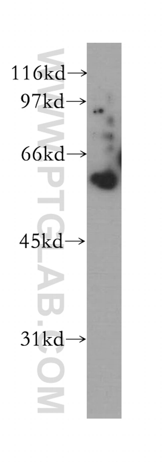 COASY Antibody in Western Blot (WB)