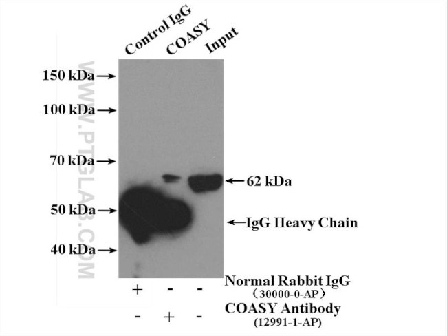 COASY Antibody in Immunoprecipitation (IP)