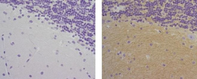 CD56 (NCAM) Antibody in Immunohistochemistry (Paraffin) (IHC (P))