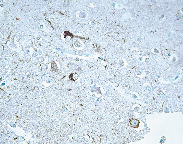 Tau Antibody in Immunohistochemistry (IHC)