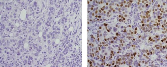 Mouse IgG2a kappa Isotype Control in Immunohistochemistry (Paraffin) (IHC (P))