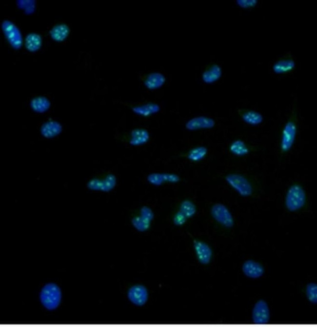 Ki-67 Antibody in Immunocytochemistry (ICC/IF)