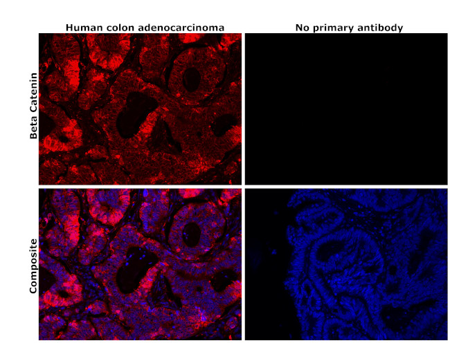 beta Catenin Antibody in Immunohistochemistry (Paraffin) (IHC (P))