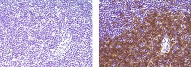 CD4 Antibody in Immunohistochemistry (Paraffin) (IHC (P))