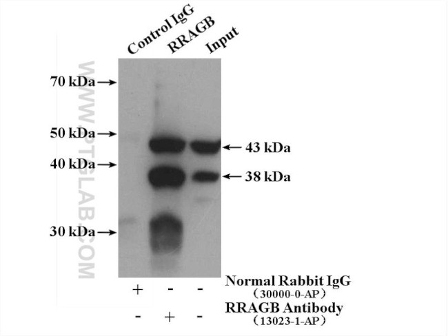 RRAGB Antibody in Immunoprecipitation (IP)