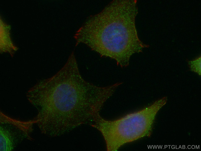 TRIM37 Antibody in Immunocytochemistry (ICC/IF)