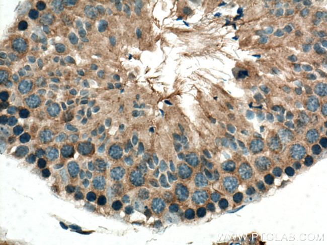 TRIM37 Antibody in Immunohistochemistry (Paraffin) (IHC (P))