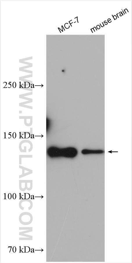 TRIM37 Antibody in Western Blot (WB)