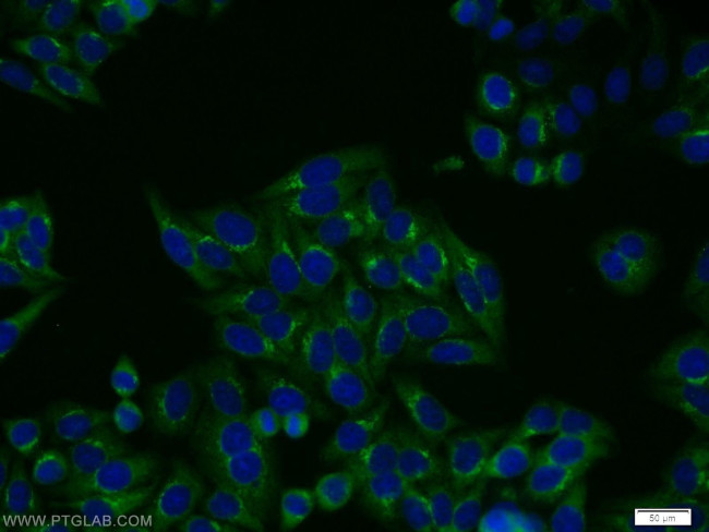 FGFR2 Antibody in Immunocytochemistry (ICC/IF)