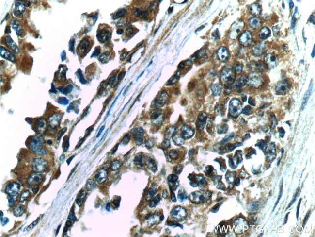 FGFR2 Antibody in Immunohistochemistry (Paraffin) (IHC (P))