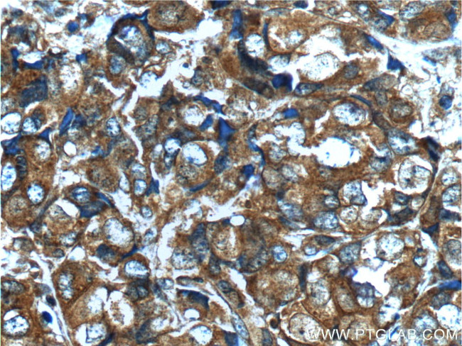 FGFR2 Antibody in Immunohistochemistry (Paraffin) (IHC (P))