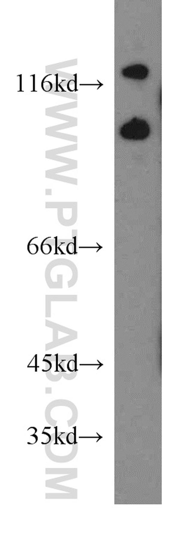 FGFR2 Antibody in Western Blot (WB)