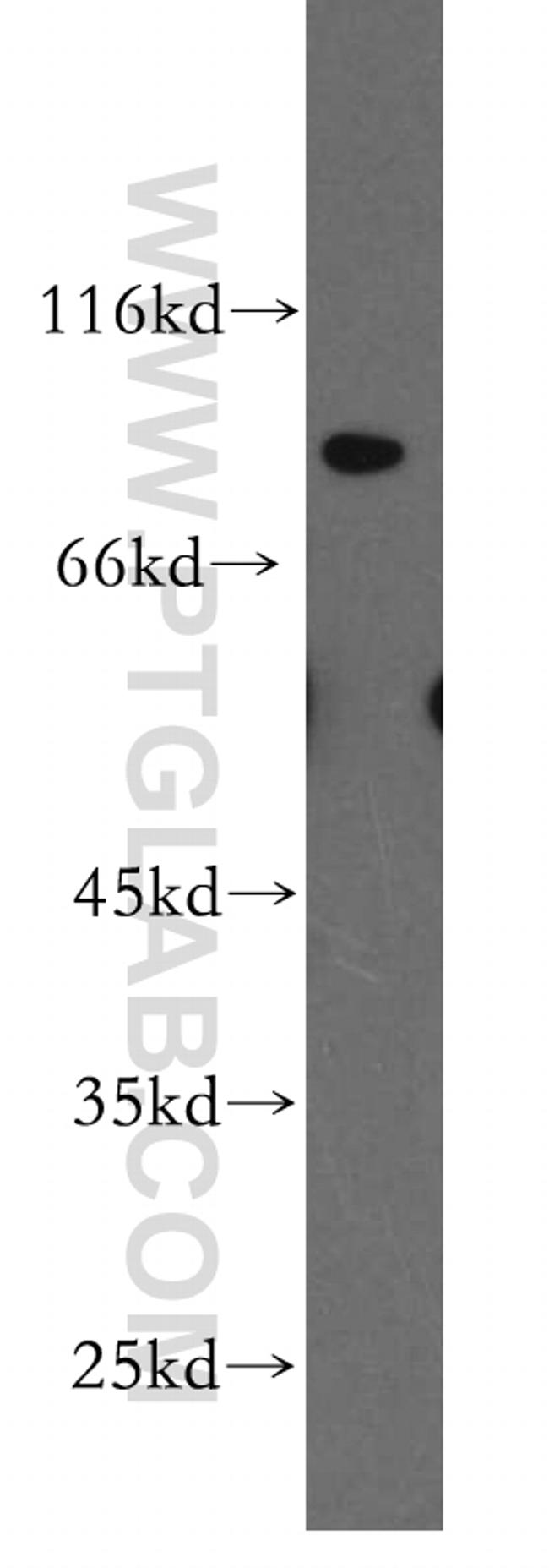 FGFR2 Antibody in Western Blot (WB)