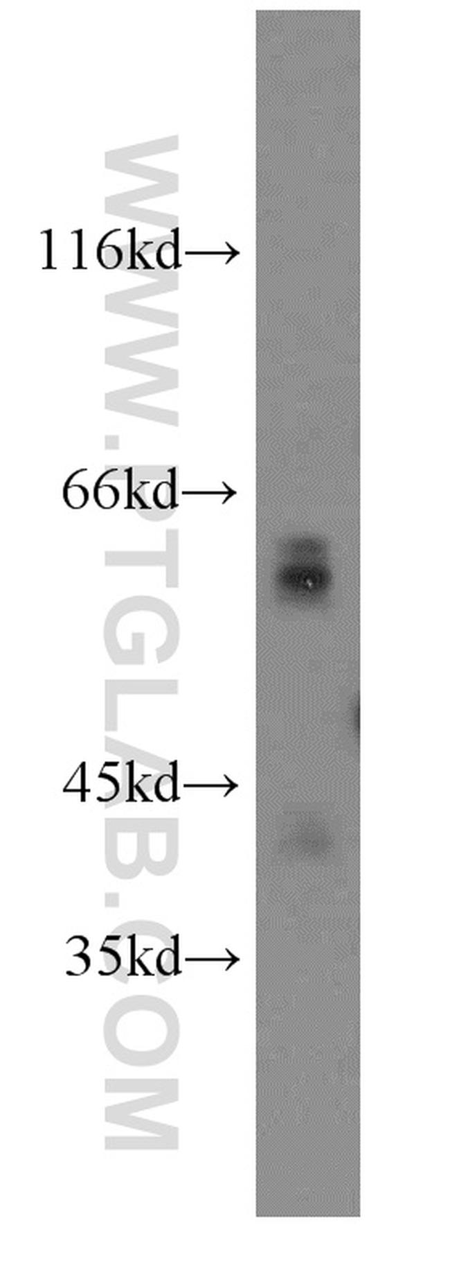 Glypican 4 Antibody in Western Blot (WB)