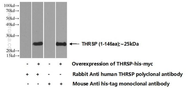 THRSP Antibody in Western Blot (WB)