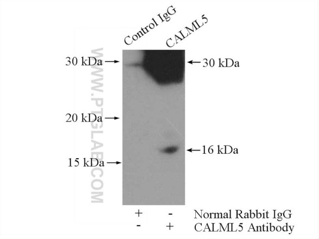 CALML5 Antibody in Immunoprecipitation (IP)