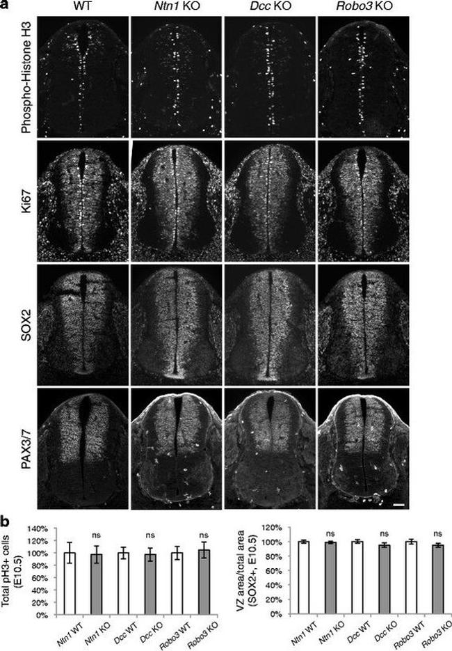 PAX3 Antibody in Immunohistochemistry (IHC)