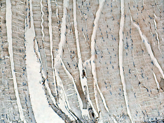 SLC1A4 Antibody in Immunohistochemistry (Paraffin) (IHC (P))