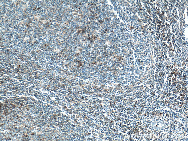 CD97 Antibody in Immunohistochemistry (Paraffin) (IHC (P))