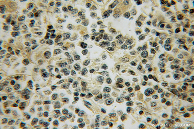 CD97 Antibody in Immunohistochemistry (Paraffin) (IHC (P))