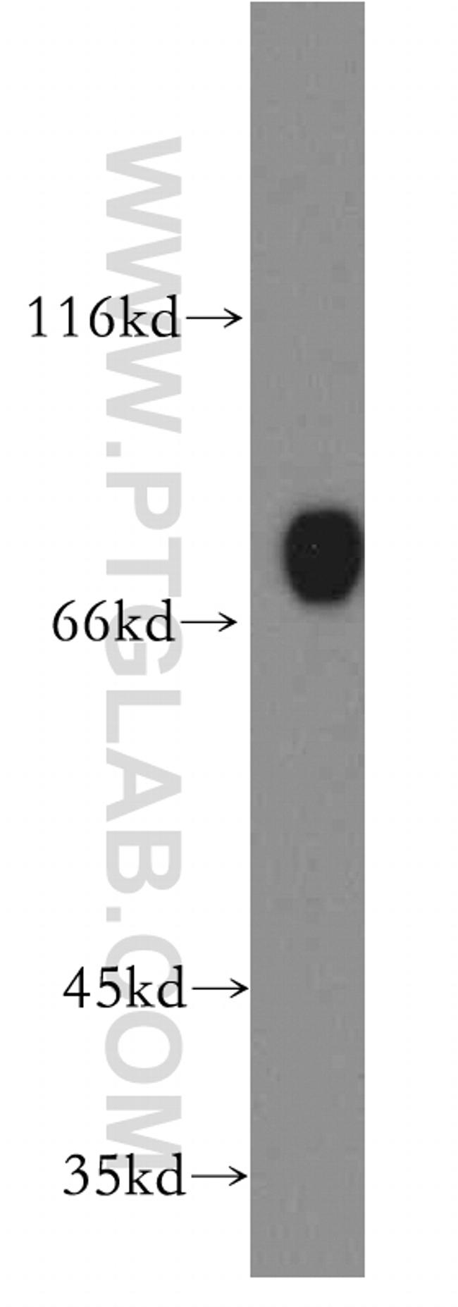 CD97 Antibody in Western Blot (WB)