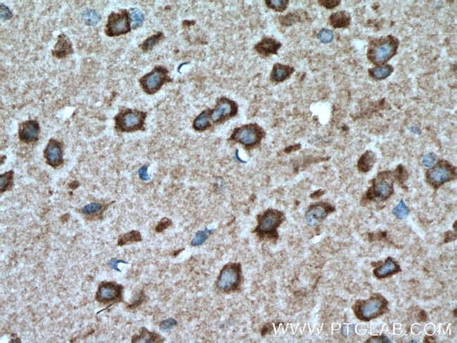 DFNA5 Antibody in Immunohistochemistry (Paraffin) (IHC (P))